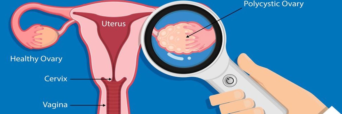 Gynaecological Problems